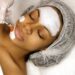 Are chemical peels worth it?