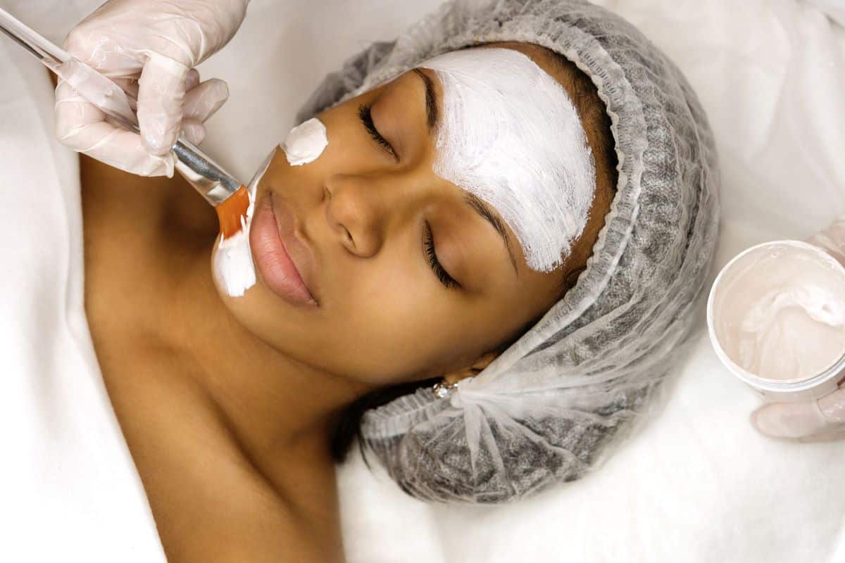 Unlocking the Secrets of Chemical Peels: Are they worth it?